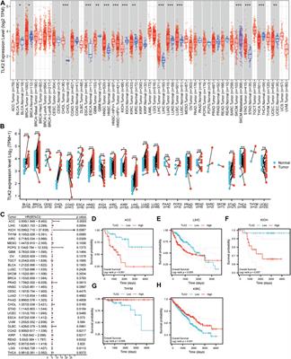 Overexpression of tousled-like kinase 2 predicts poor prognosis in HBV-related hepatocellular carcinoma patients after radical resection